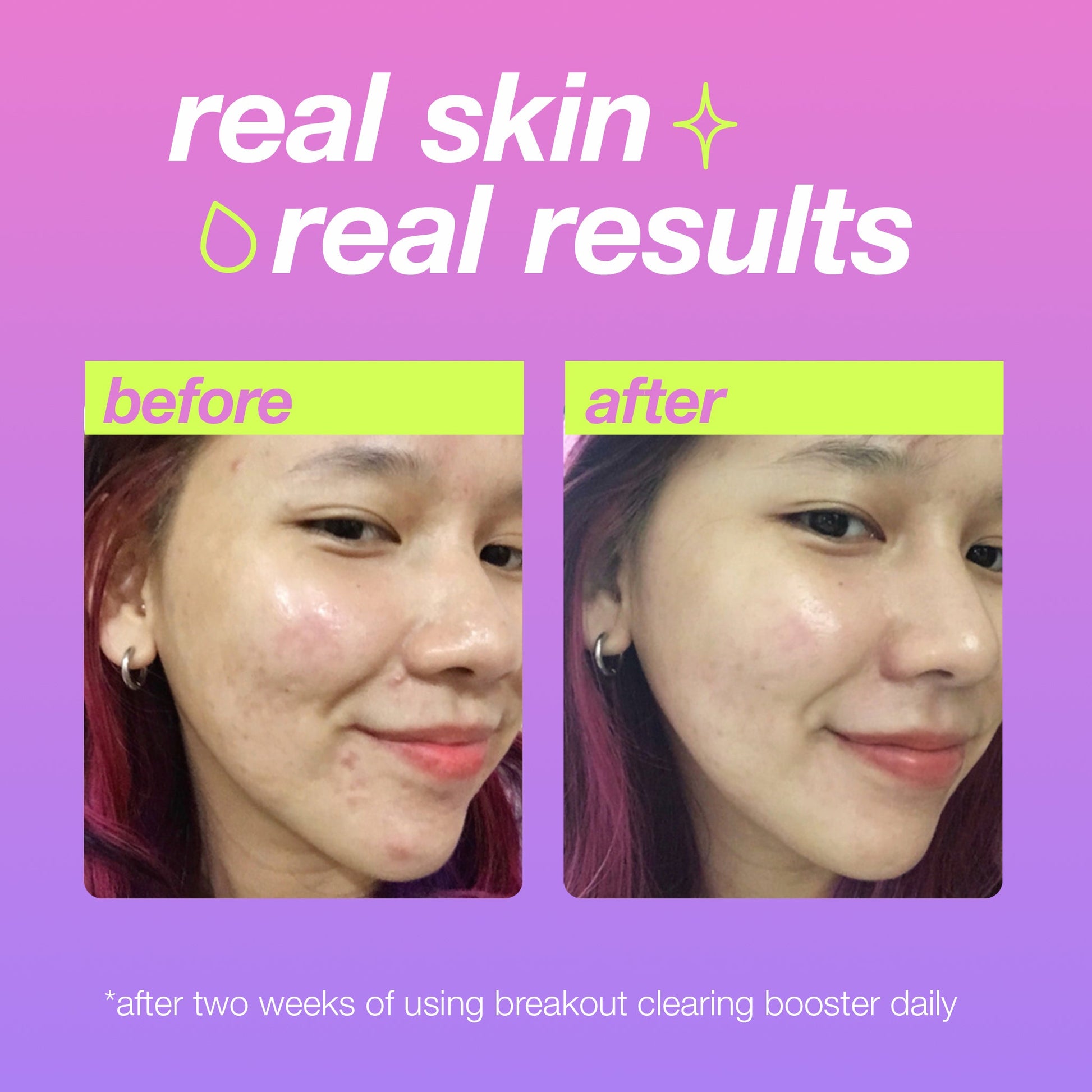 breakout clearing booster real skin real results
