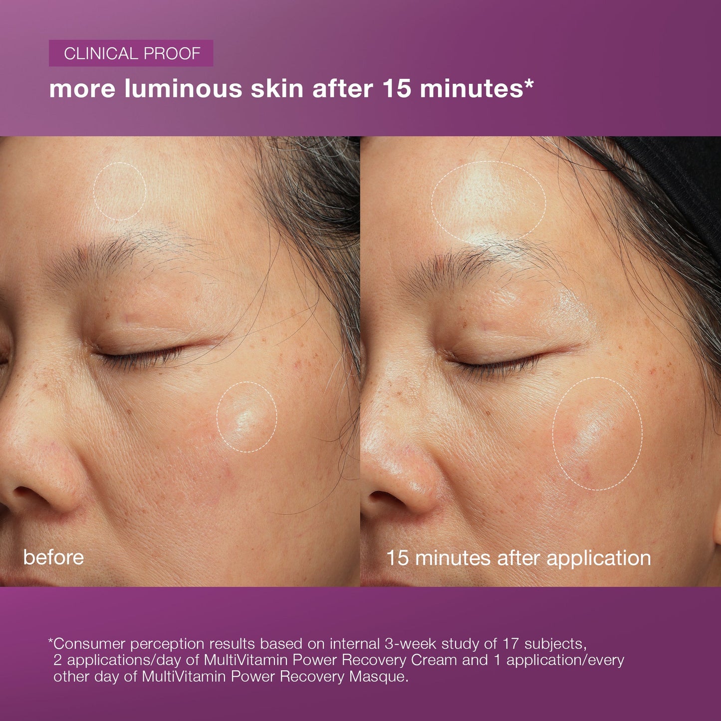 stressed skin recovery system before and after