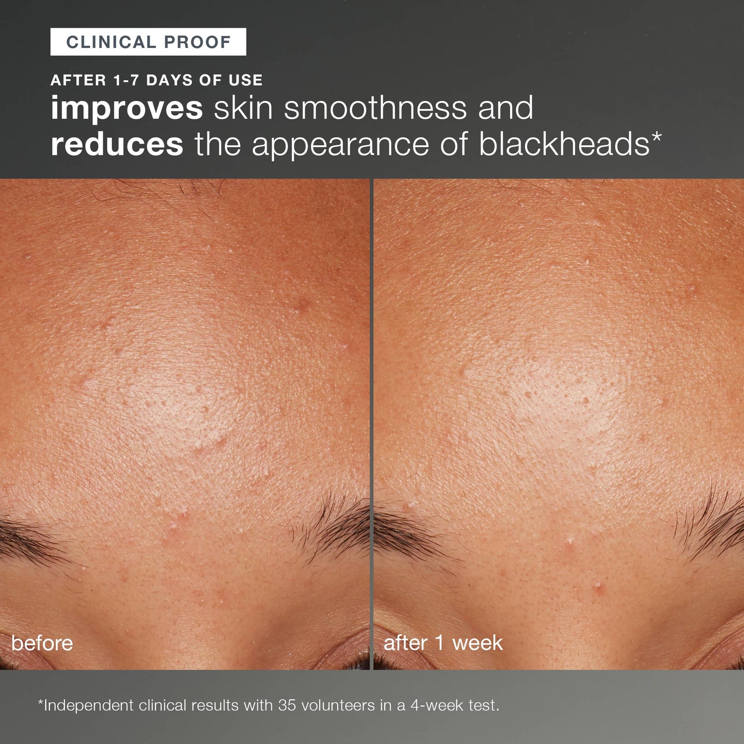 daily microfoliant exfoliator