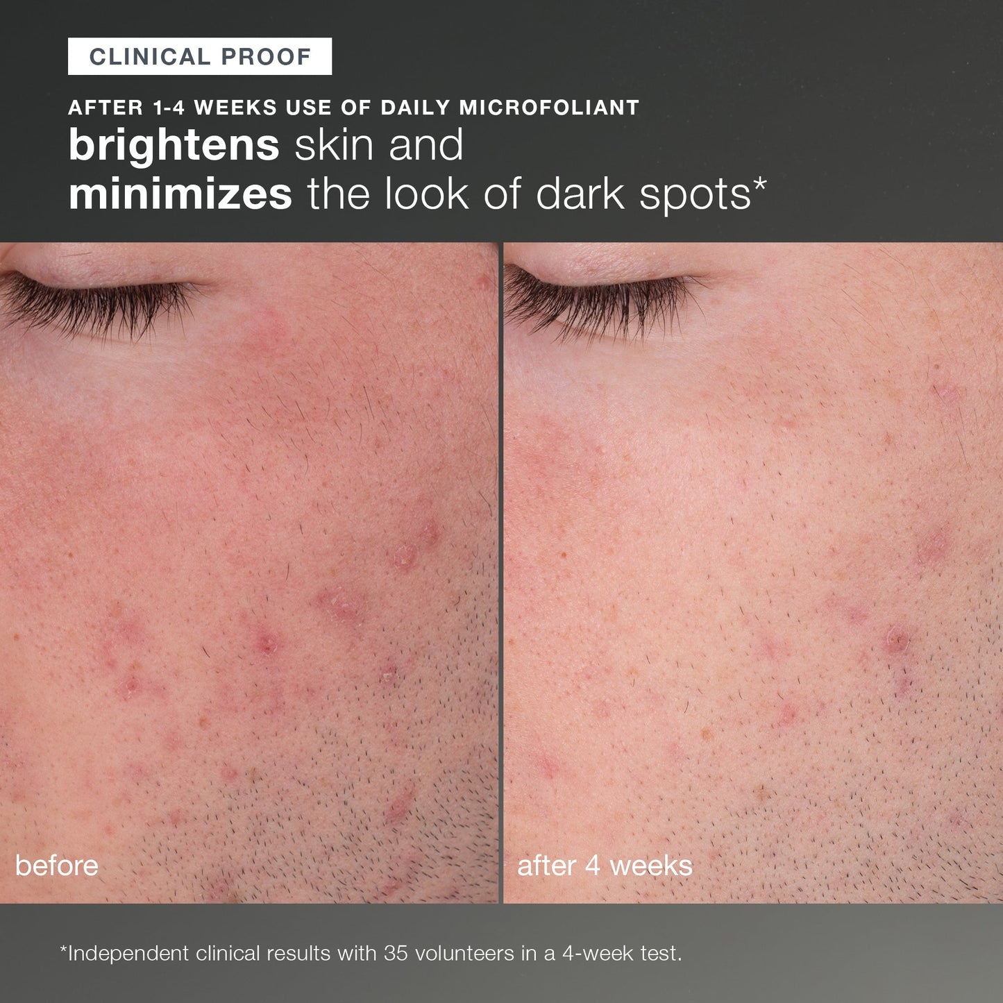 discover healthy skin kit clinical