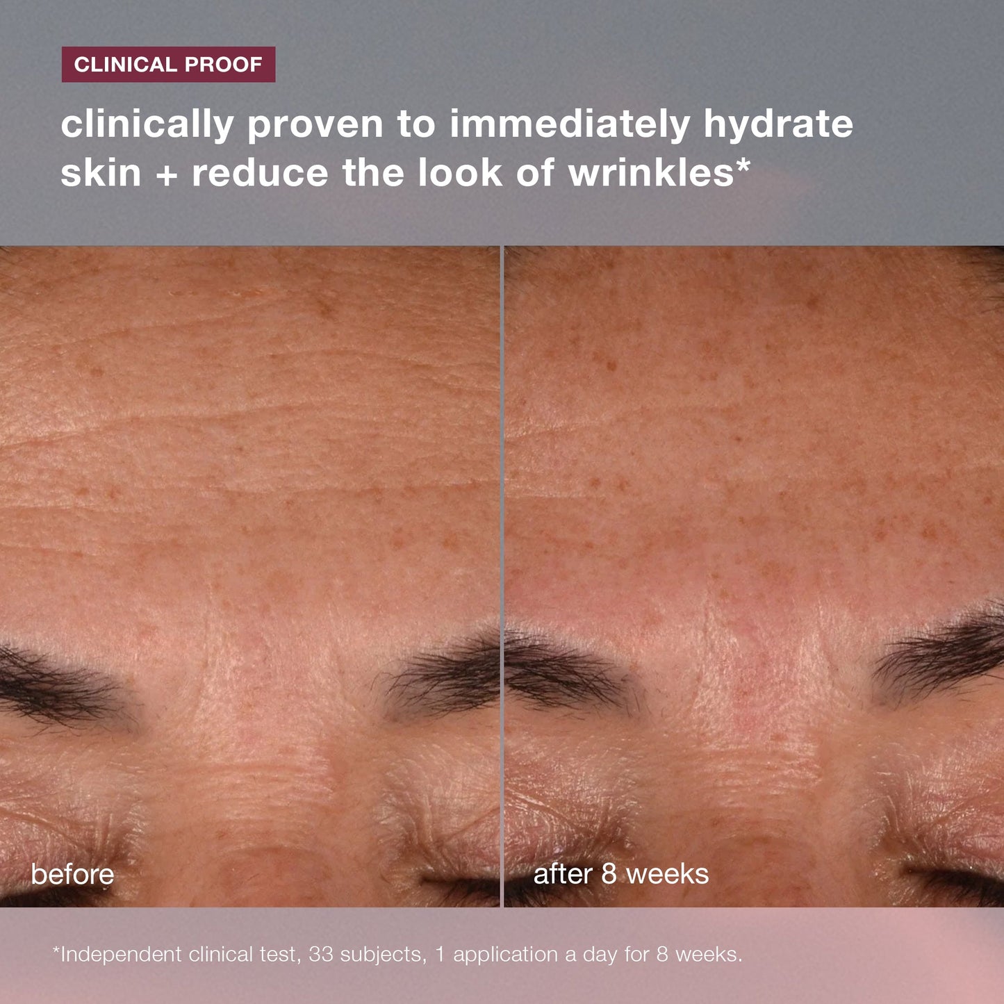 dynamic skin recovery spf50 clinical