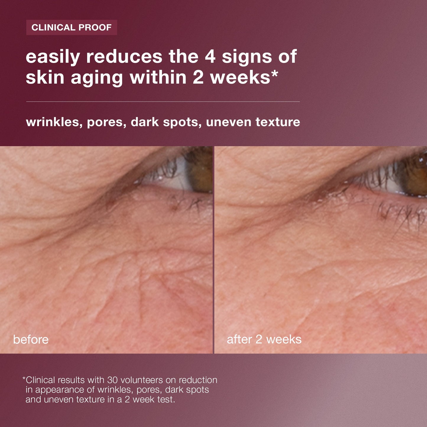 dynamic skin retinol serum clinical