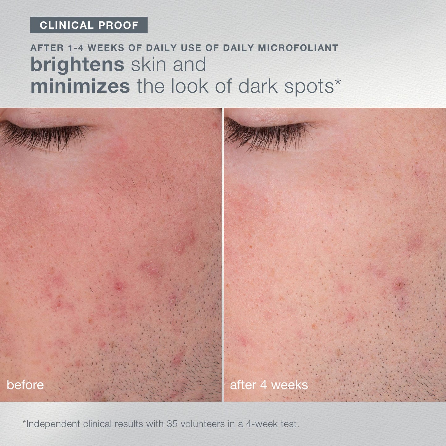 expertise set clinical for daily microfoliant