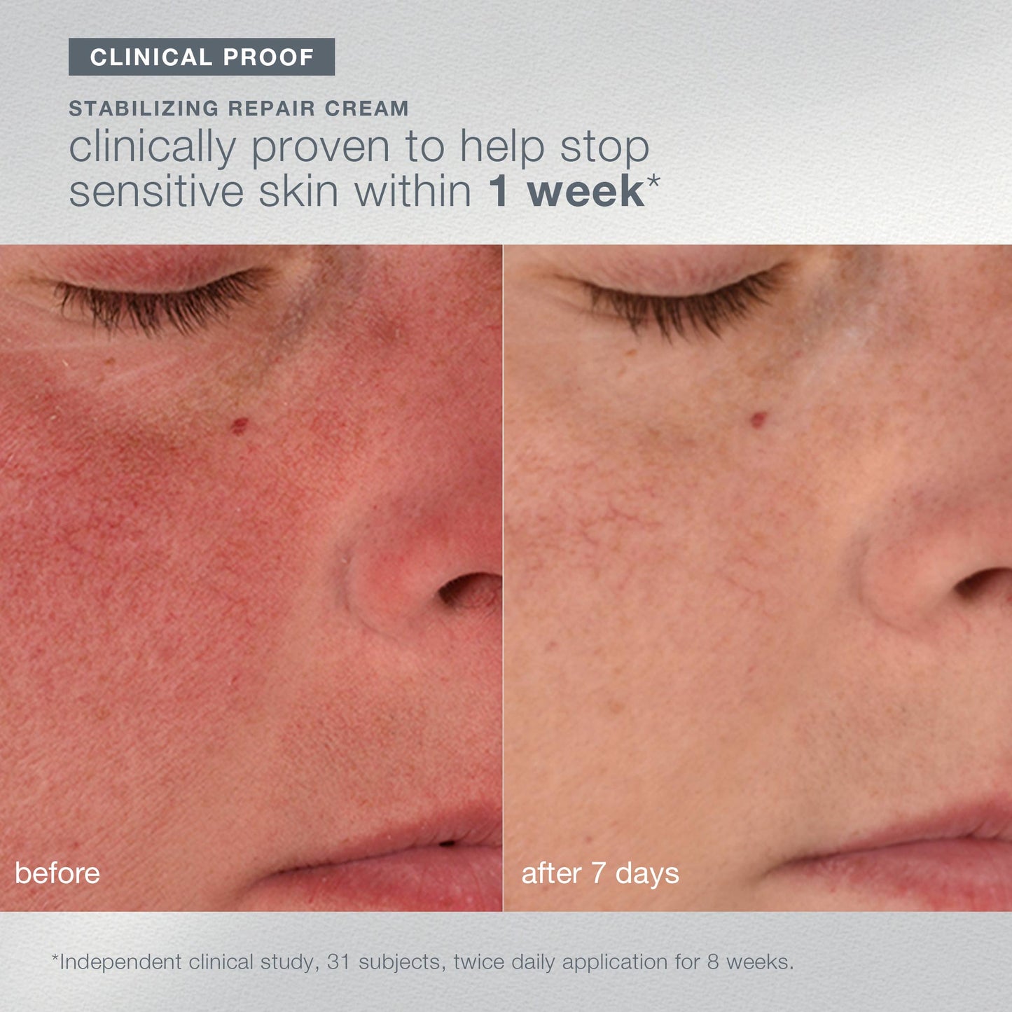 home for the holidays set clinical for stabilizing repair cream