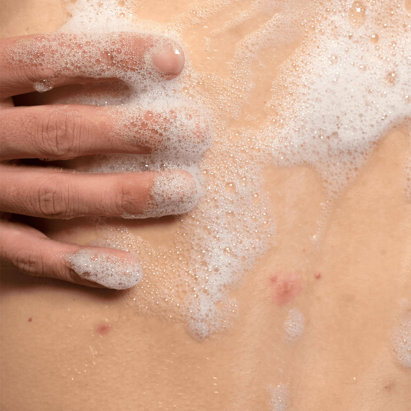 back treatment 