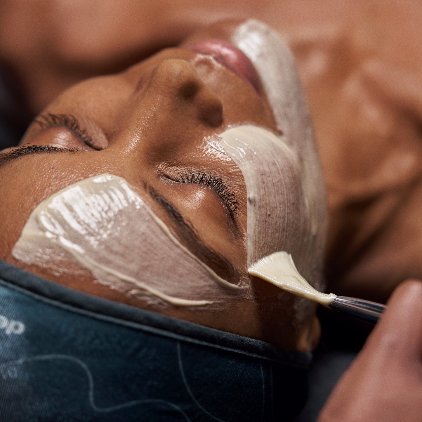 model receiving skin treatment