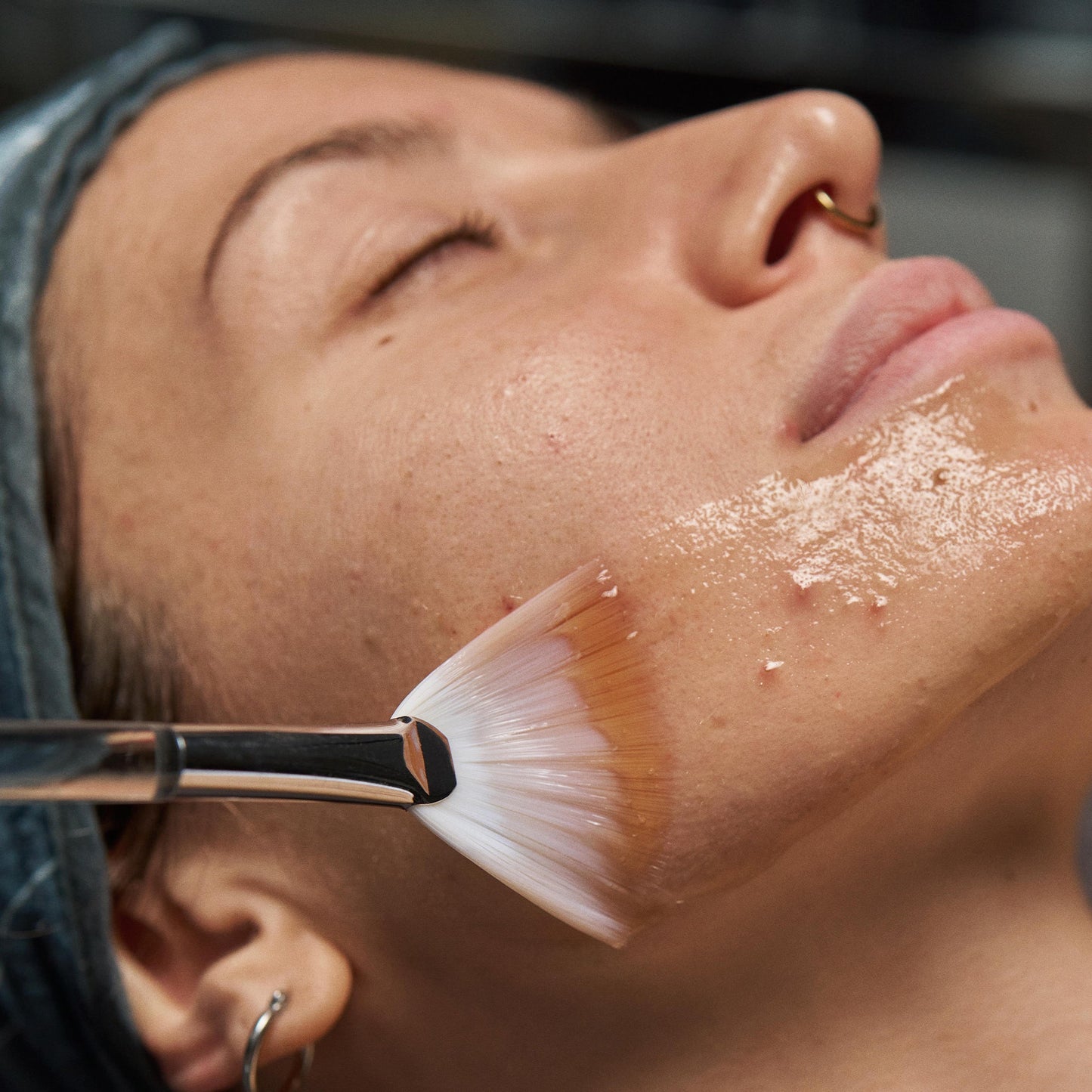 model receiving skin treatment