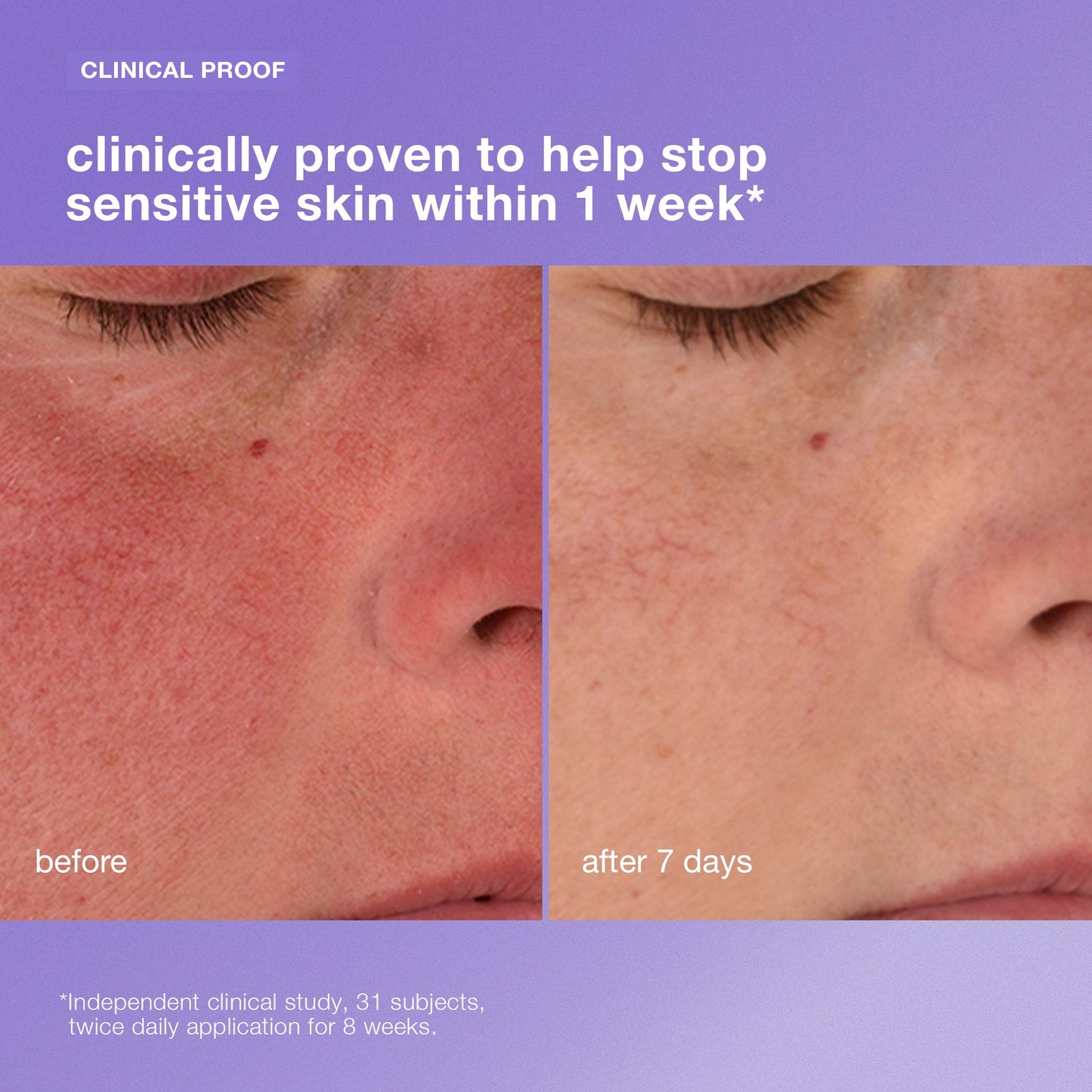 stabilizing repair cream clinical
