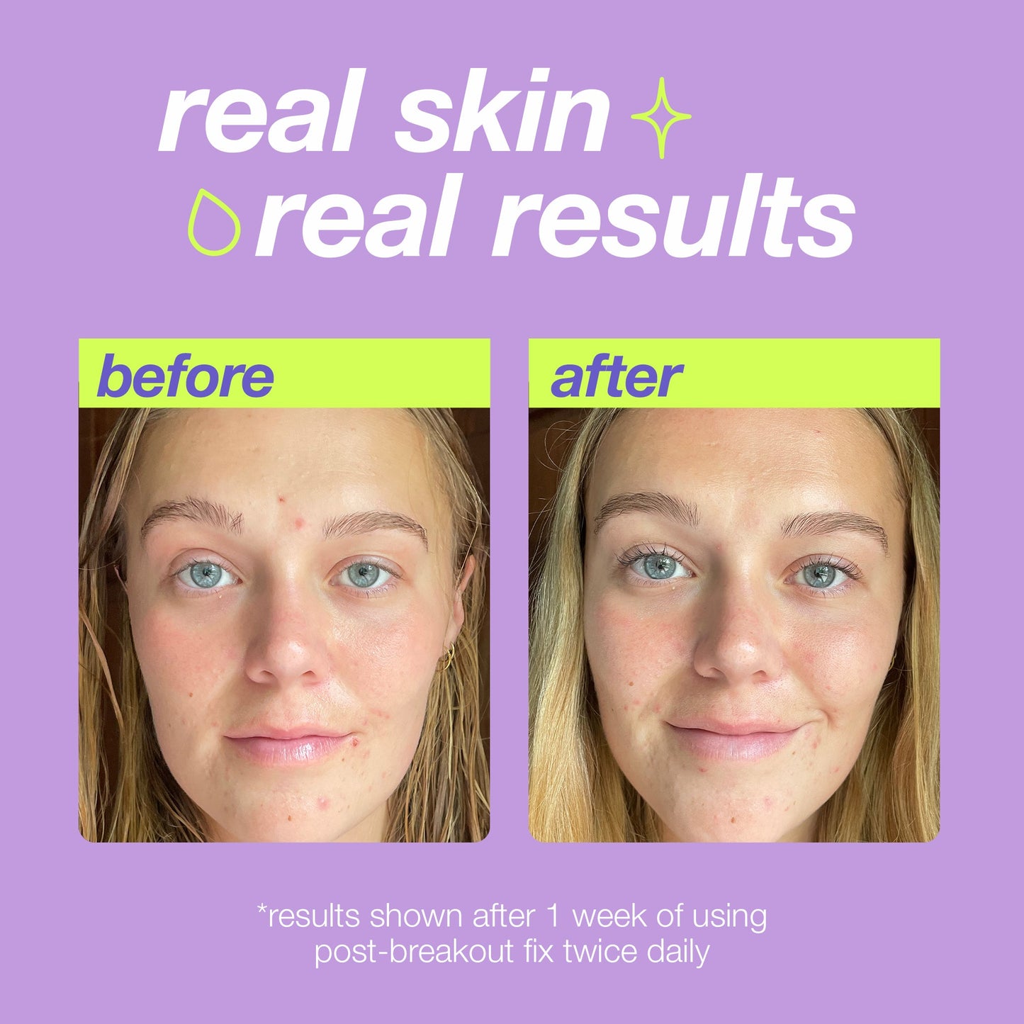 Before and after results using Post-Breakout Fix