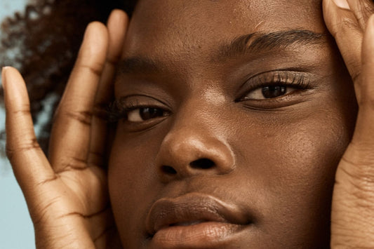 can oily skin be dehydrated?