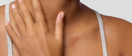 eczema-prone skin? these daily habits can help reduce flare-ups