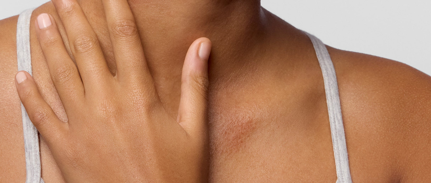 eczema-prone skin? these daily habits can help reduce flare-ups