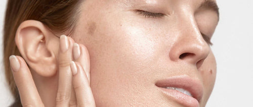 what causes uneven skin tone?