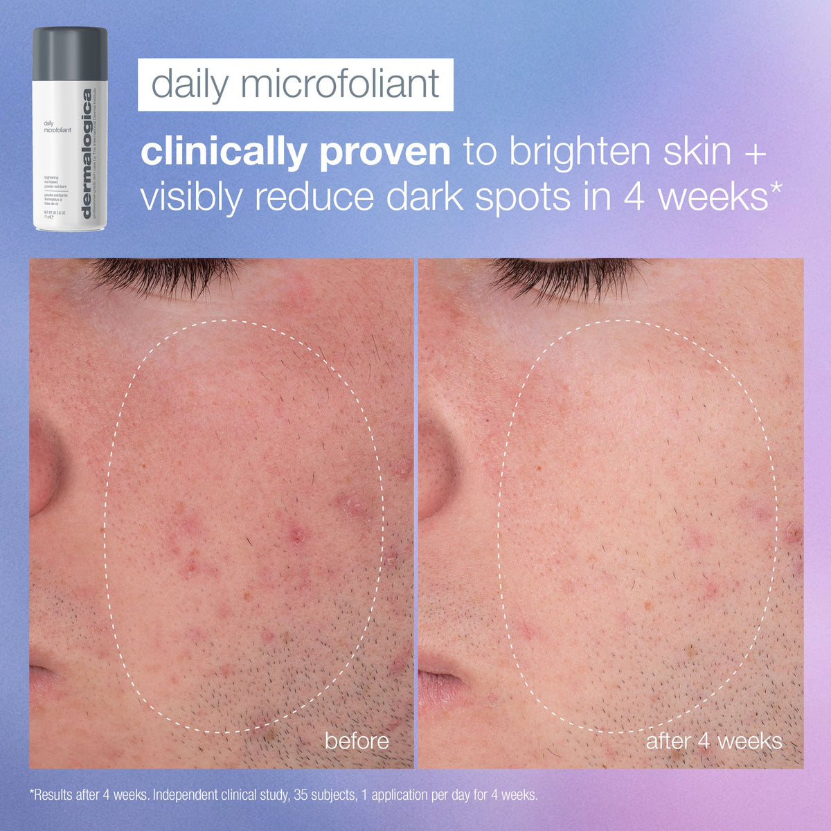 daily microfoliant duo (full-size + free travel size, HSA/FSA eligible) 