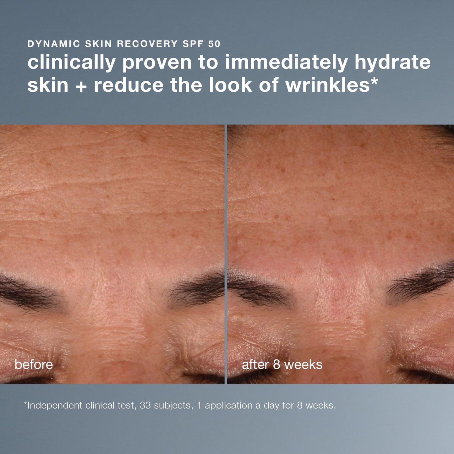 dynamic skin recovery spf50 clinical 