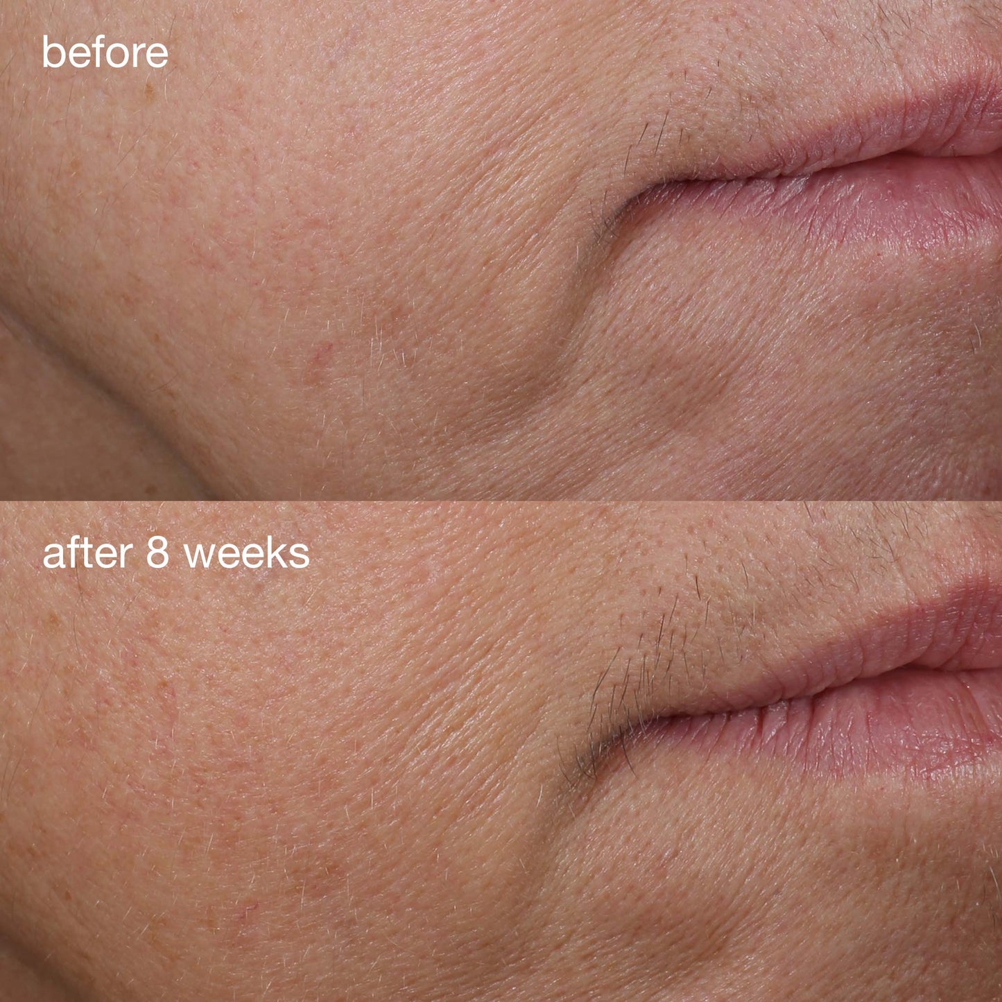 phyto nature firming serum before and after 8 weeks
