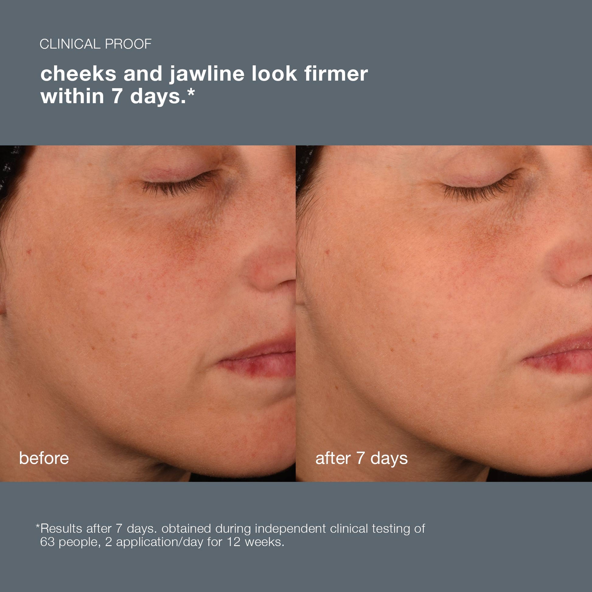 pro-collagen banking serum before and after