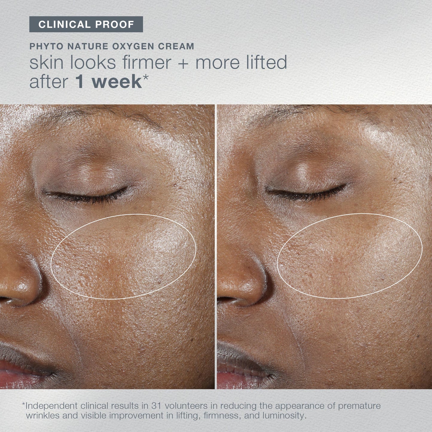 a moment in nature set clinical proof for phyto nature oxygen cream 