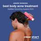 award winning best body acne treatment