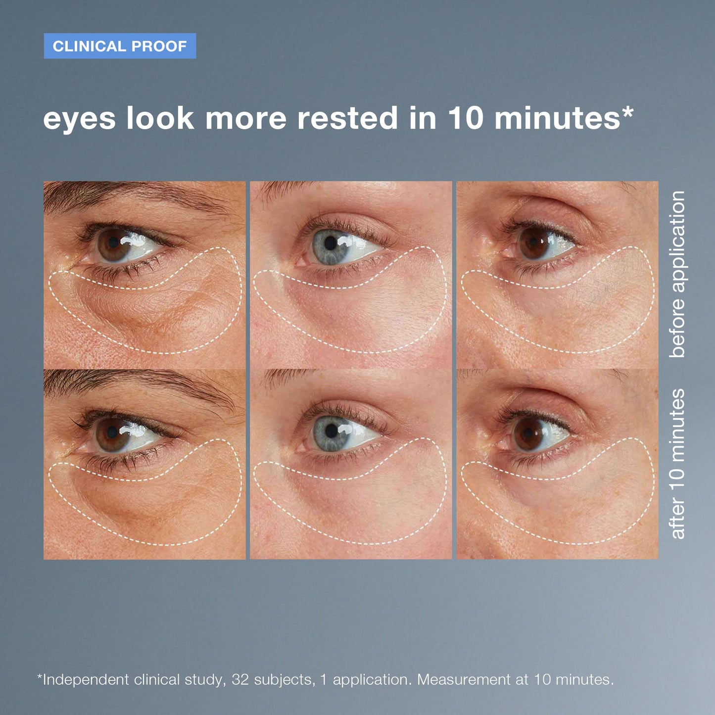 awaken peptide depuffing eye gel before and after 