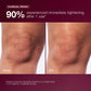 dynamic skin sculptor clinical