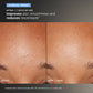 daily microfoliant clinical
