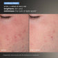 daily microfoliant exfoliator clinical
