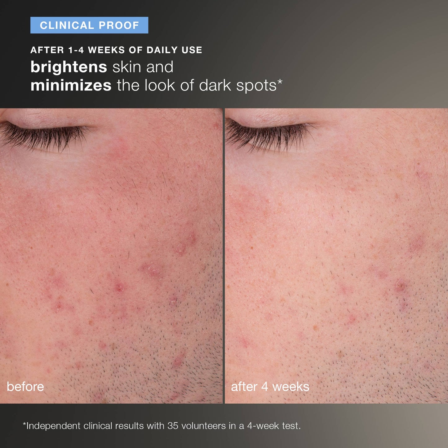 daily microfoliant exfoliator clinical 