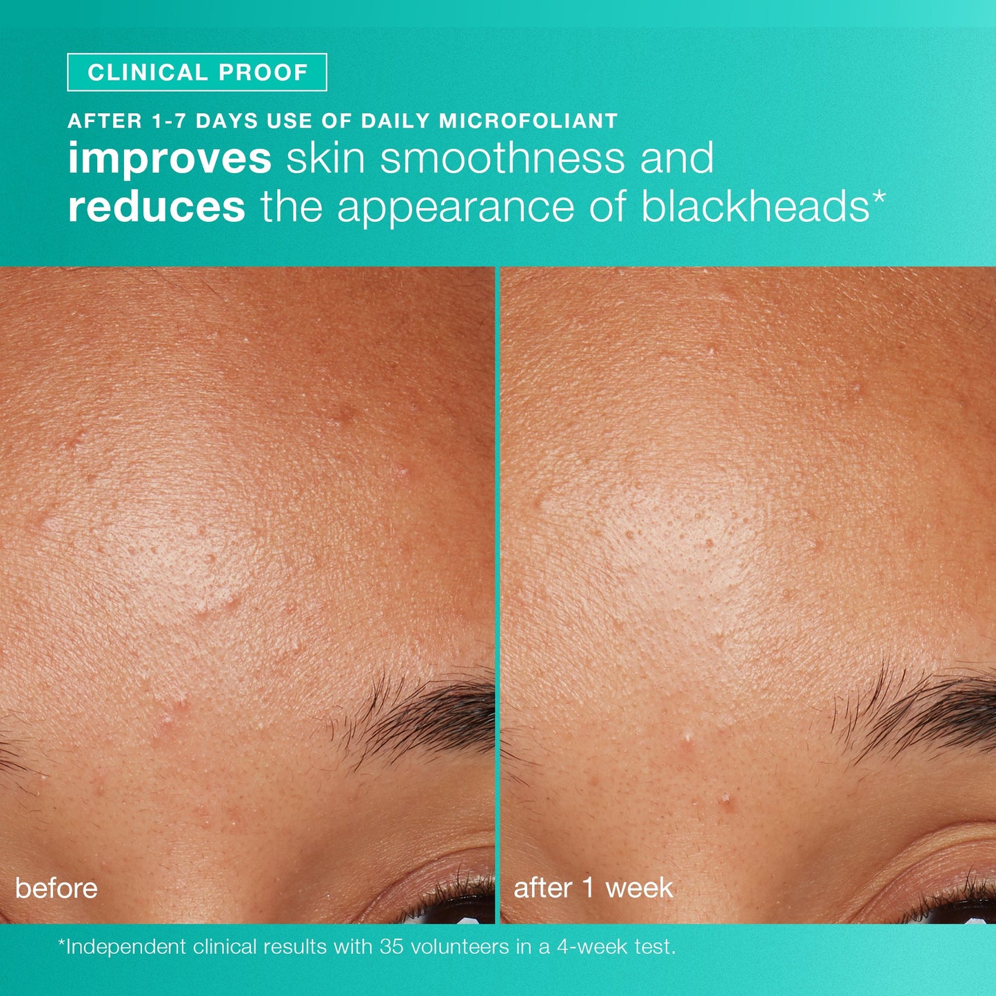 clear and brighten kit clinical proof 