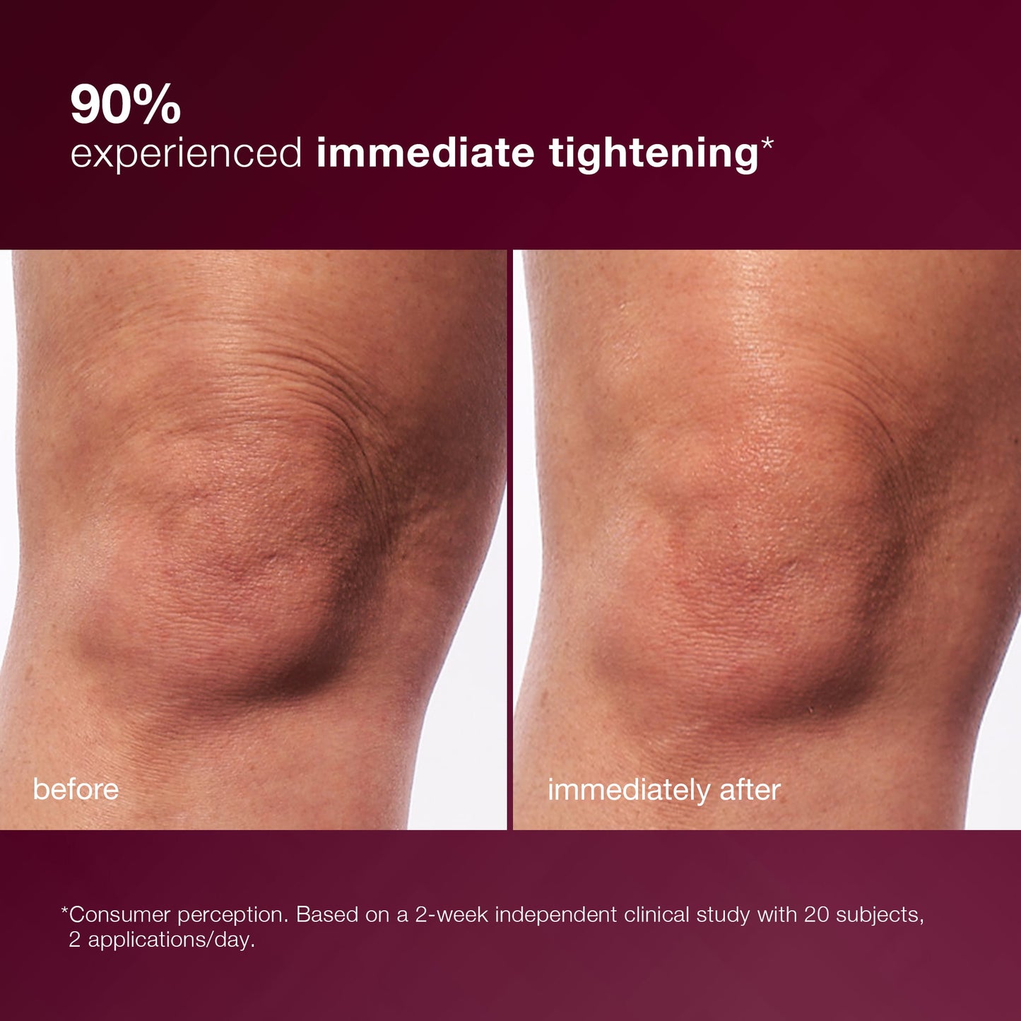 dynamic skin sculptor body serum before and after 