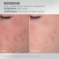 expertise set clinical for daily microfoliant