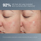 magnetic[+] afterglow cleanser before and after