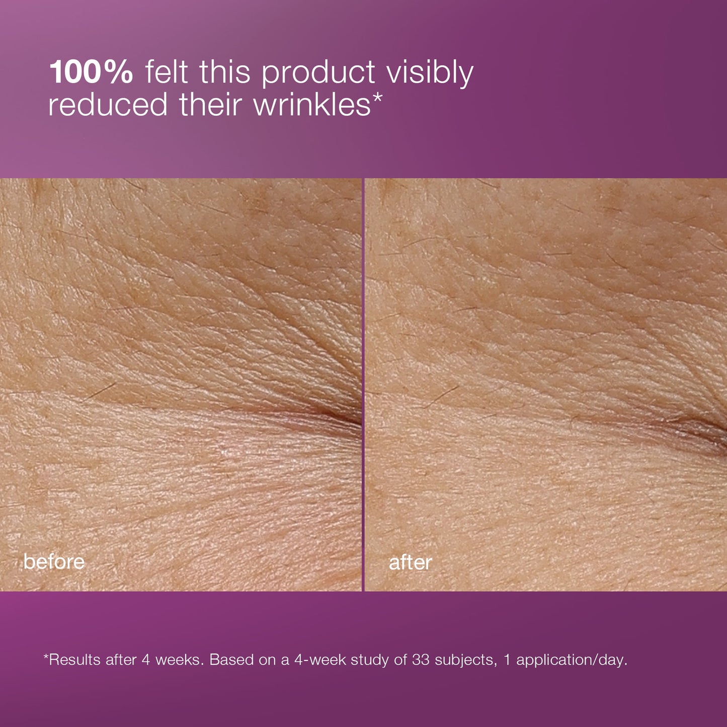multivitamin power recovery cream before and after 