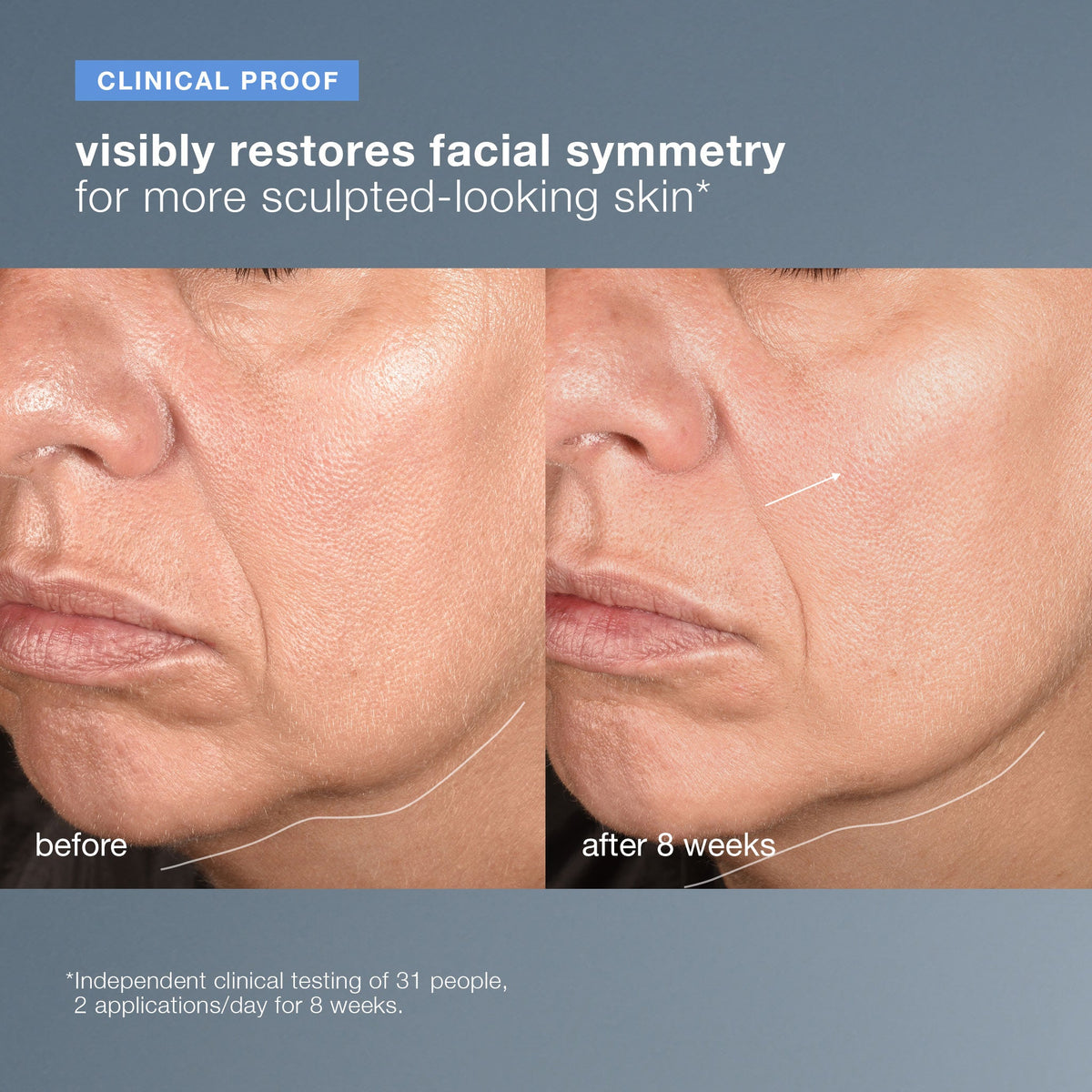 NeuroTouch Symmetry Serum | Facial Sculpting Skin Care – Dermalogica