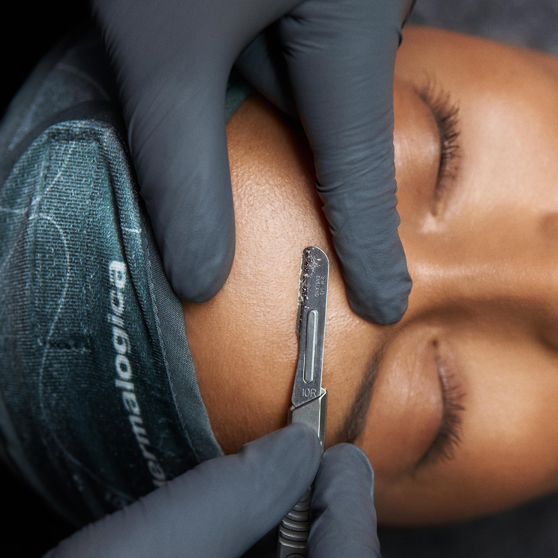 model receiving skin treatment