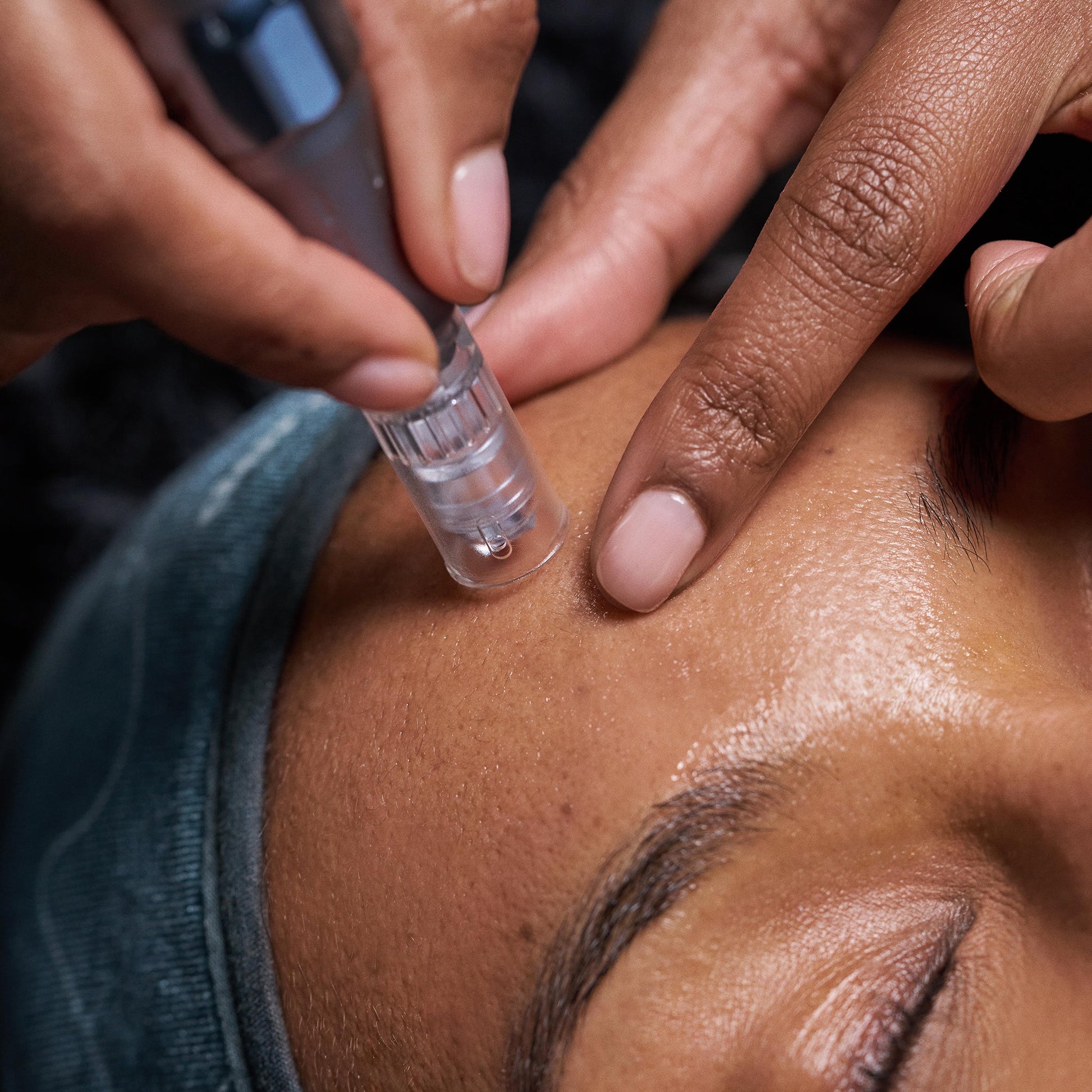 model receiving pro nanoinfusion treatment