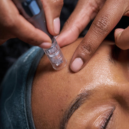 model receiving pro nanoinfusion treatment