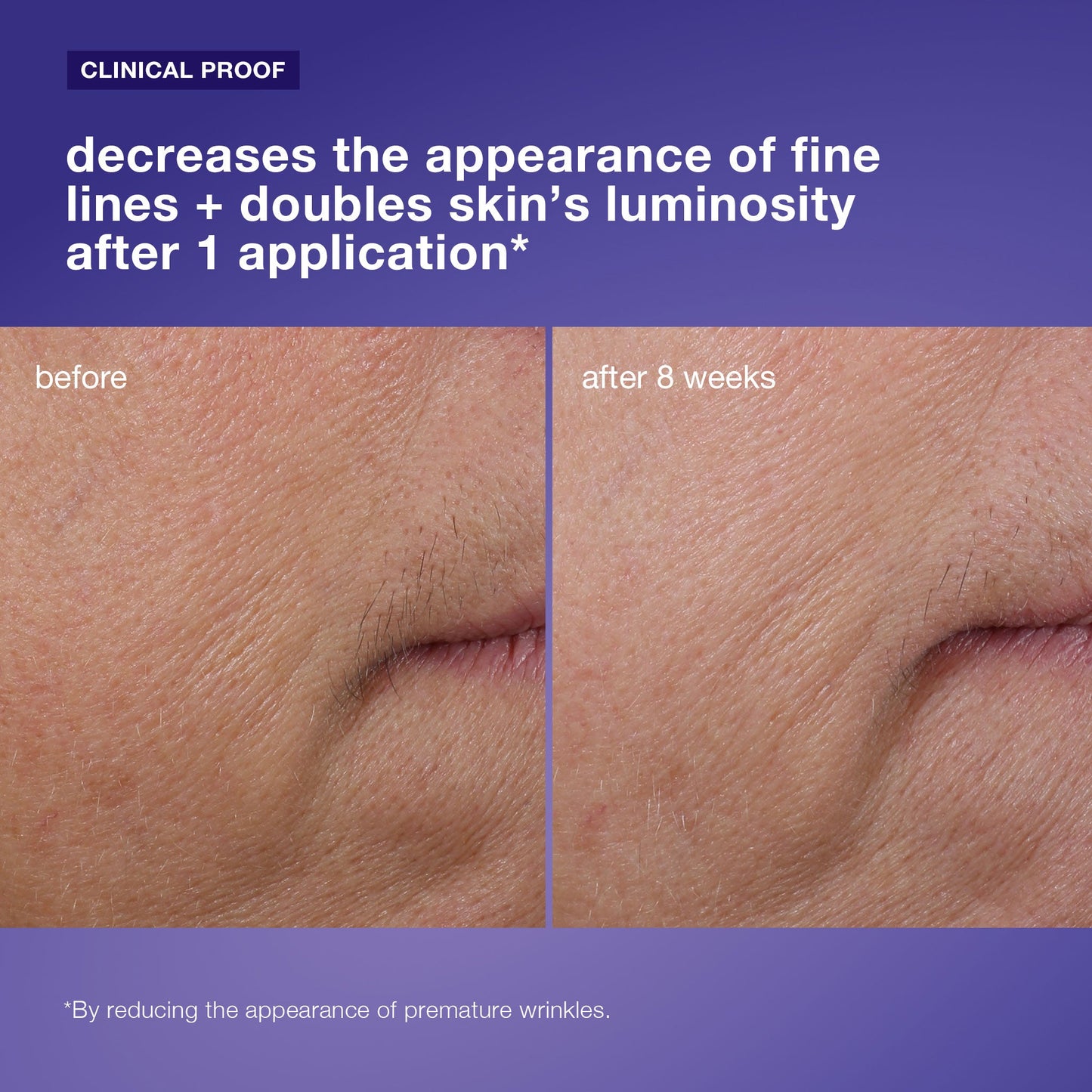 phyto nature firming serum clinical 