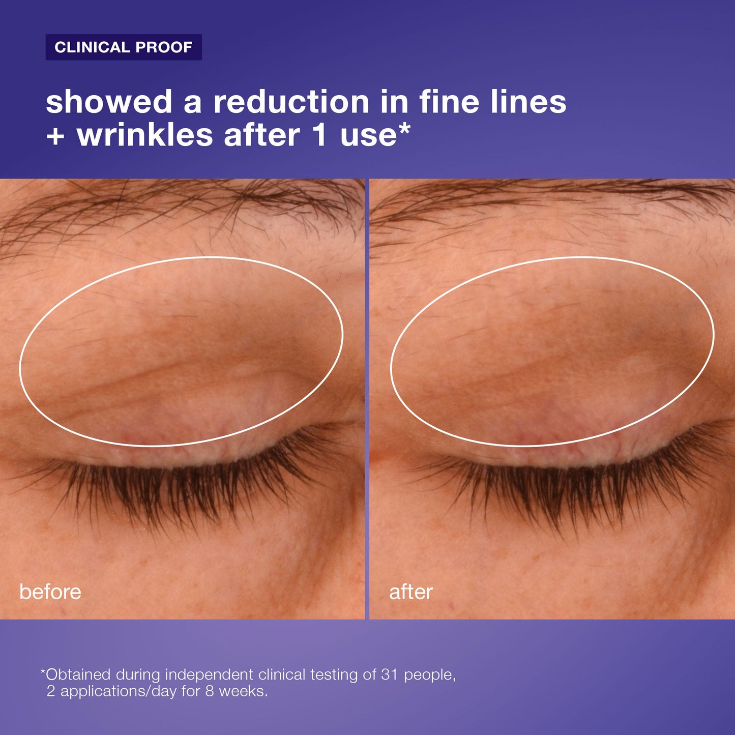 phyto nature lifting eye cream clinical 