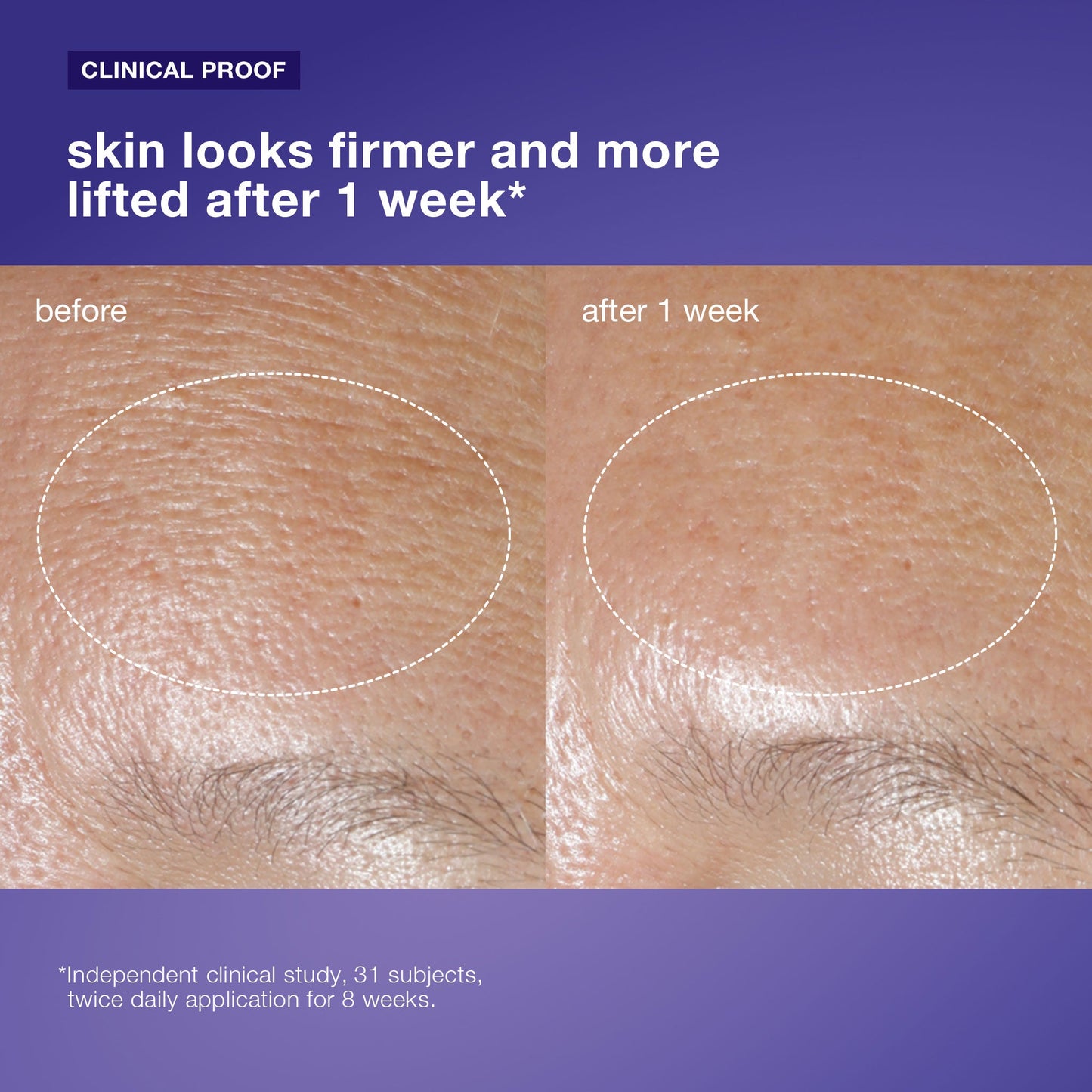 phyto nature oxygen cream clinical 