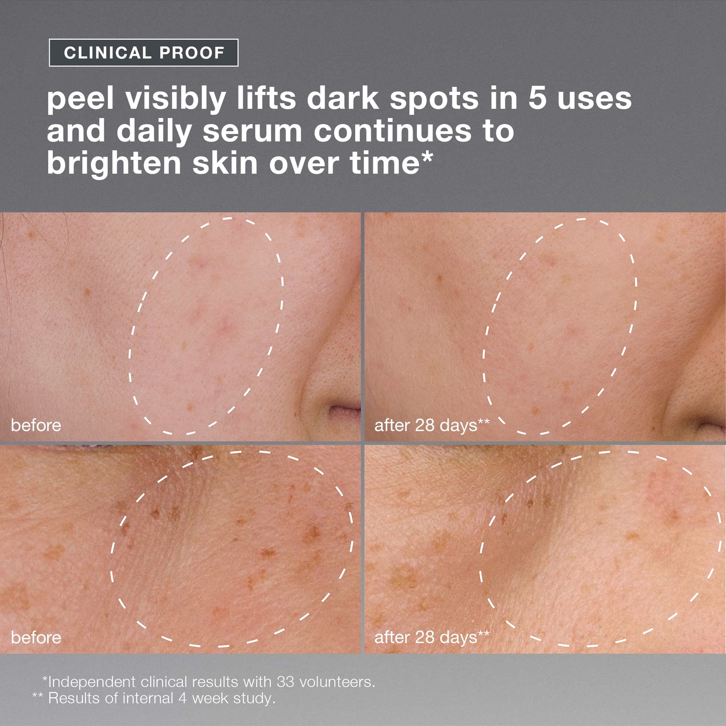 powerbright dark spot system clinical proof 