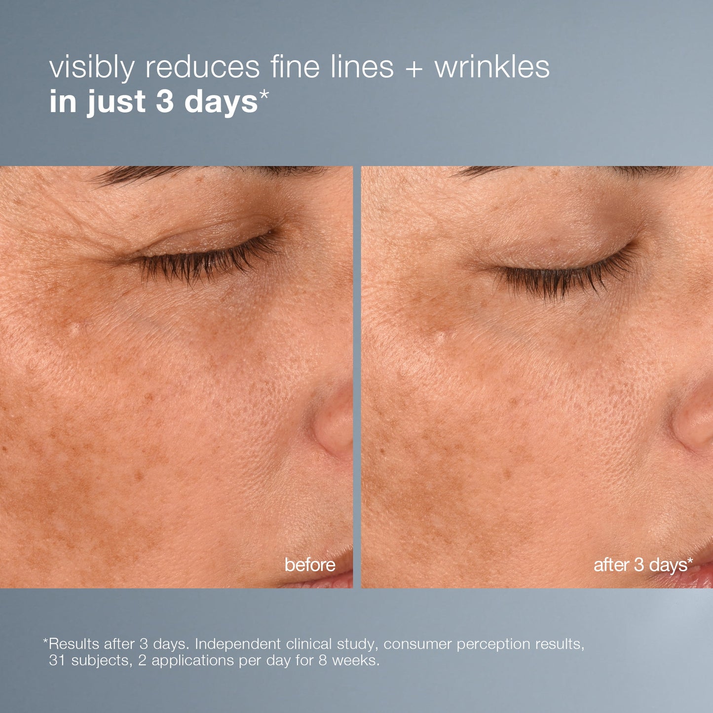 pro-collagen banking water cream before and after 