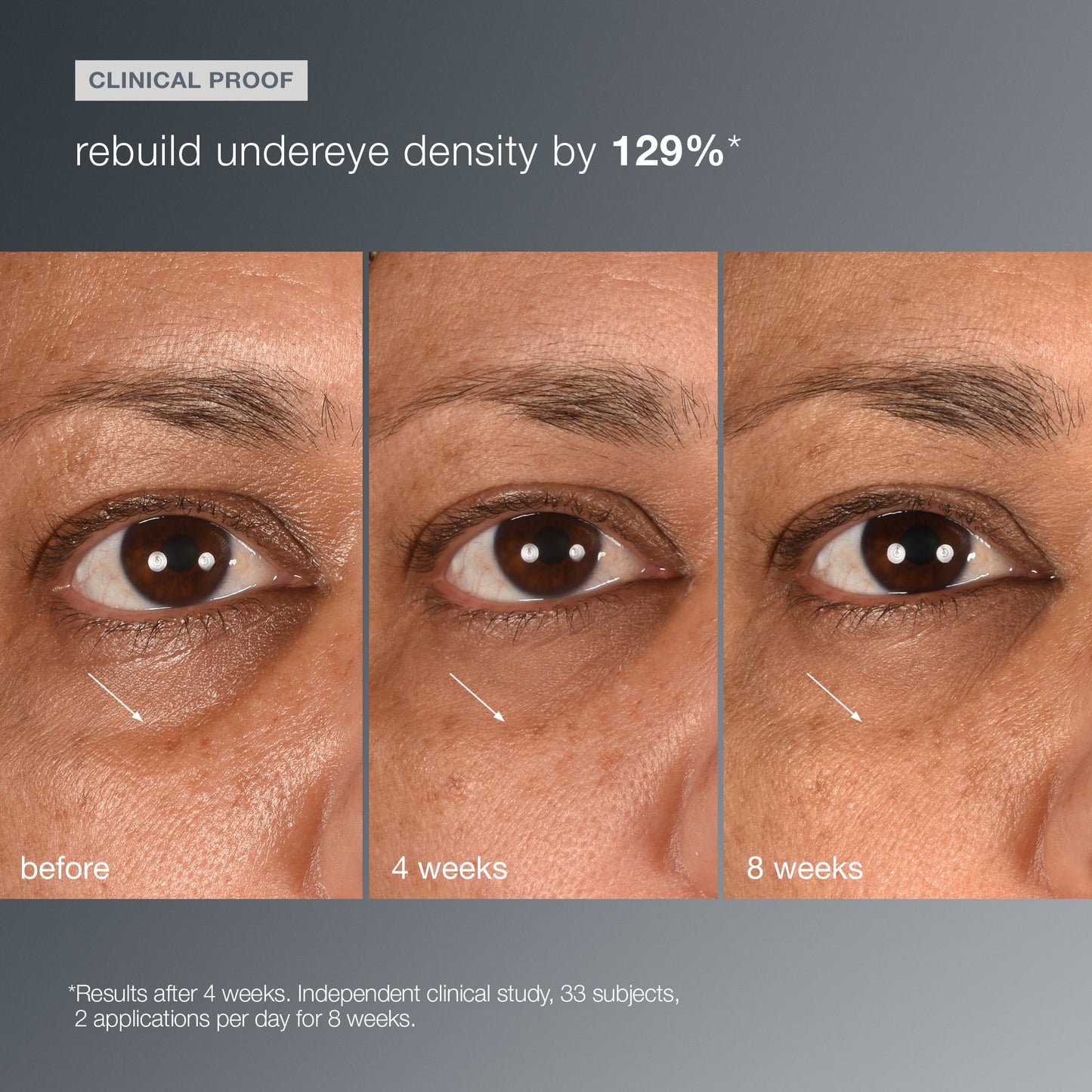 smart eye density undereye serum clinical 