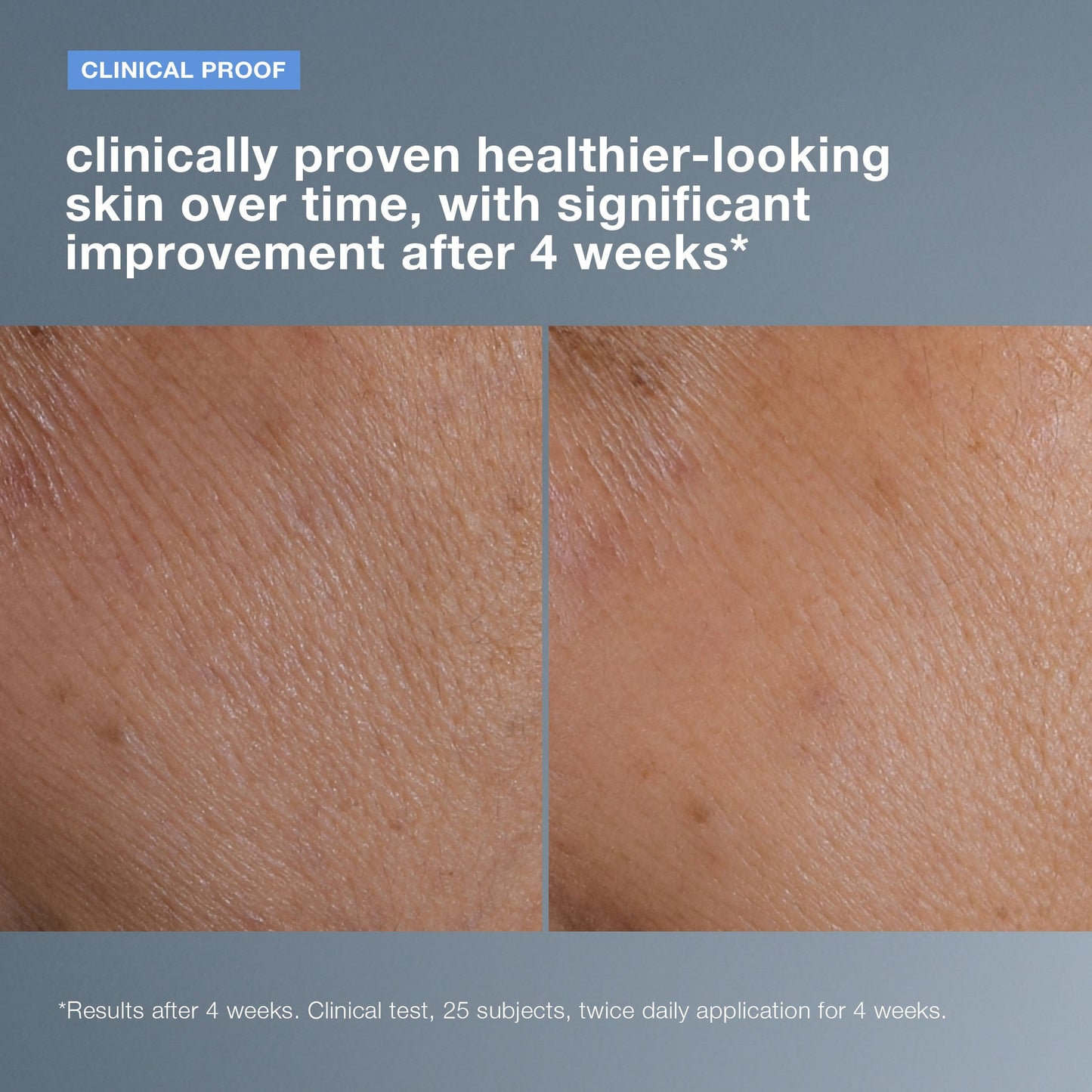 smart response serum clinical 