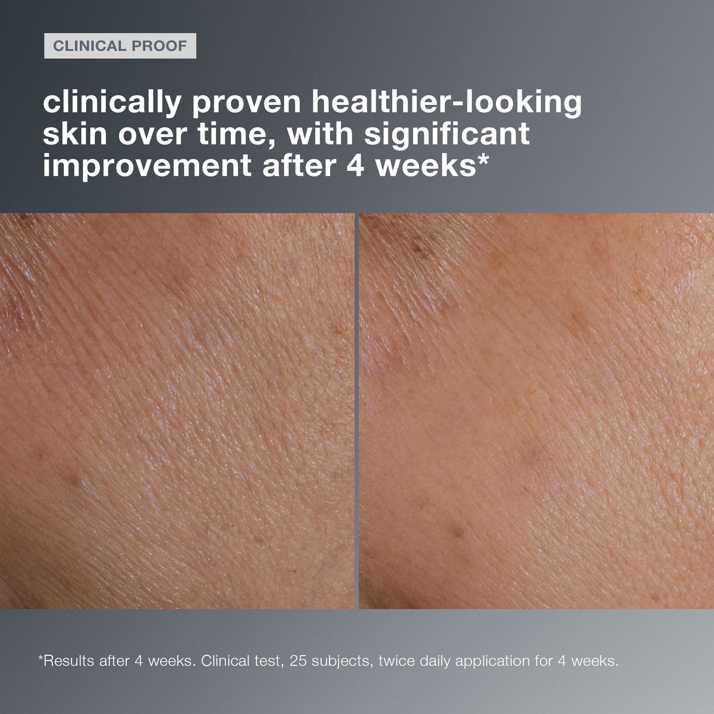 smart response serum clinical 
