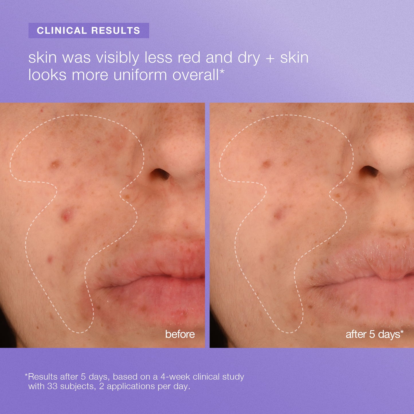 stabilizing repair face + body serum clinical 