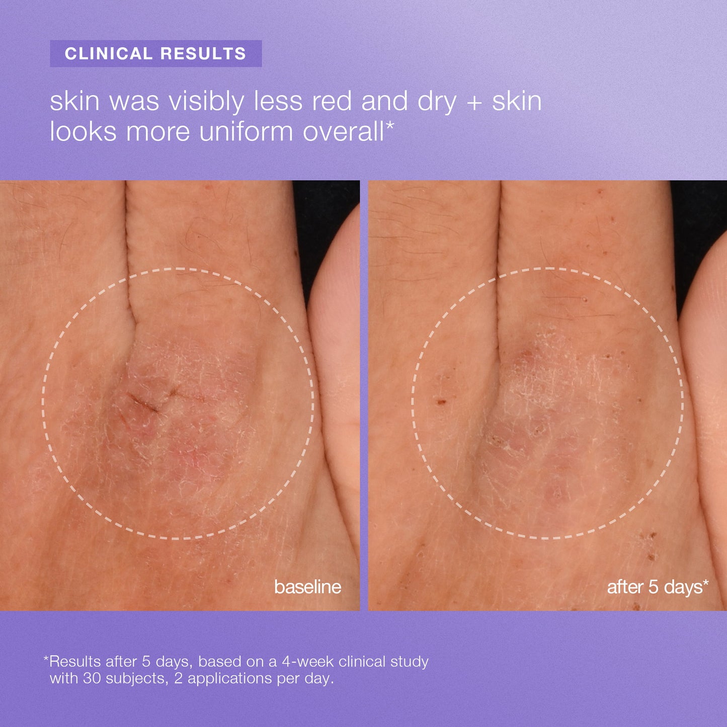 stabilizing repair face + body serum clinical 