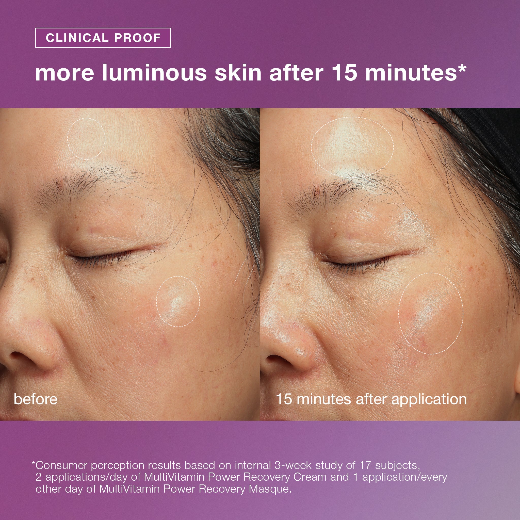 Stressed Skin Recovery System | Dermalogica®