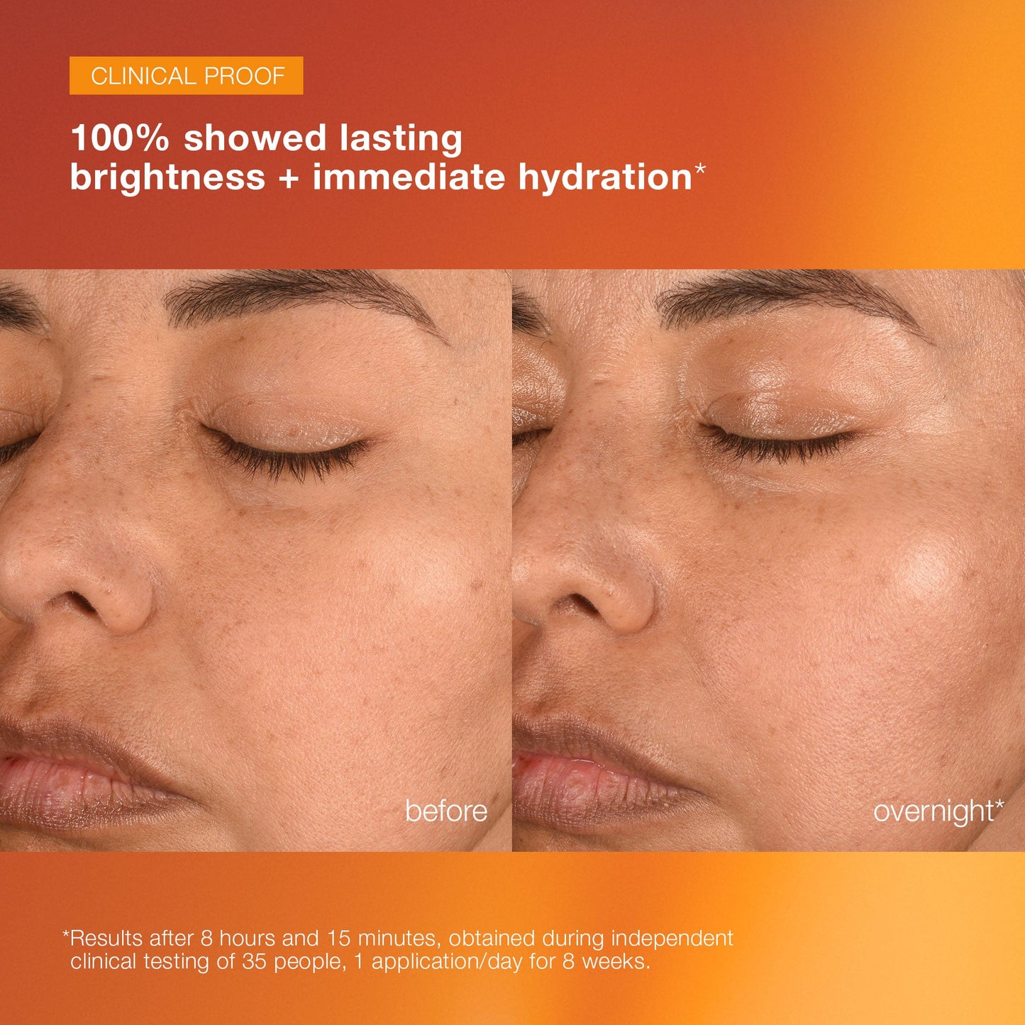 biolumin-c night restore serum clinical before and after 