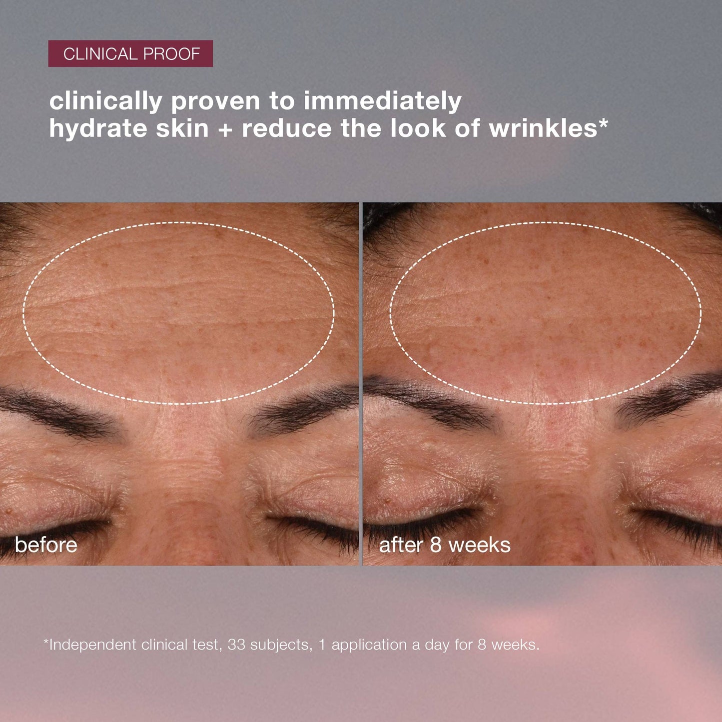 dynamic skin recovery spf50 clinical 